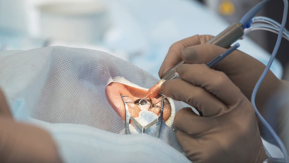 Cataract Recovery