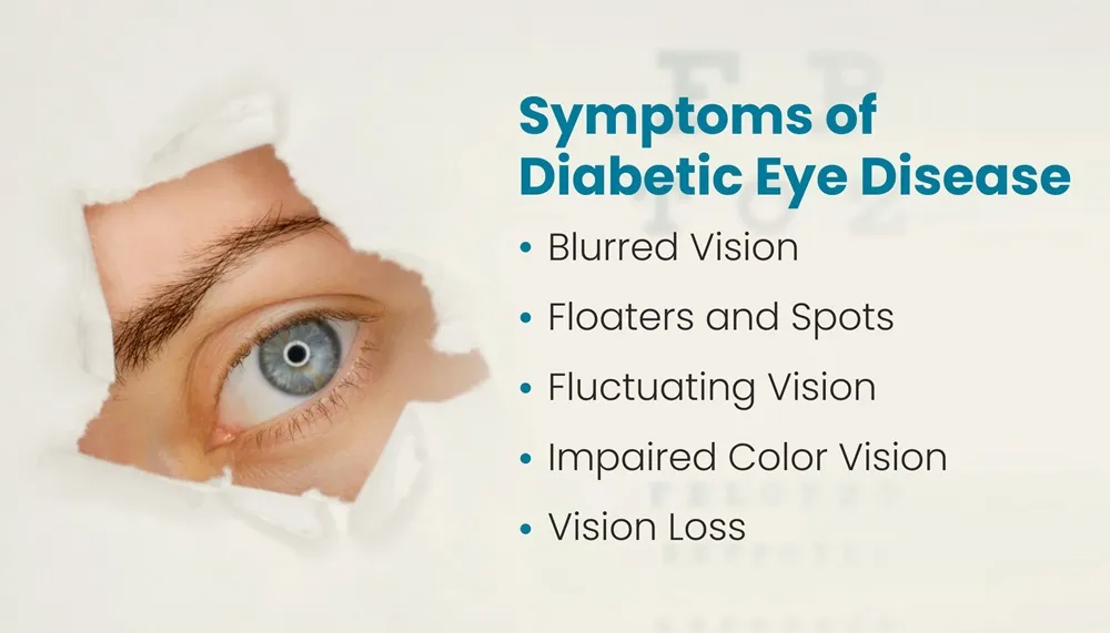 Symptoms of Diabetic Eye Disease