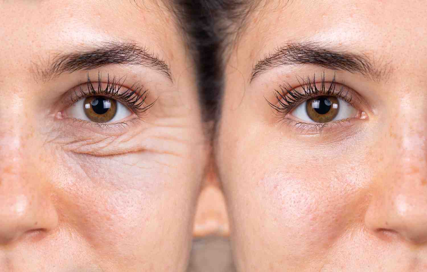 Oculoplasty Treatment Options