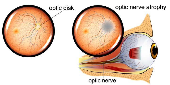 Signs You Need Optical Services